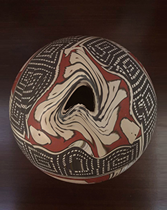 degeneracion_macular